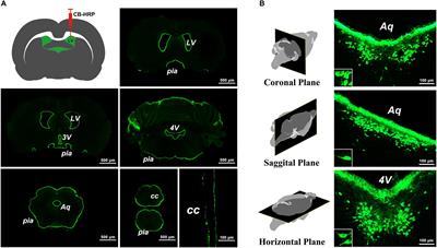 Stereotaxic Coordinates and Morphological Characterization of a Unique Nucleus (CSF-Contacting Nucleus) in Rat